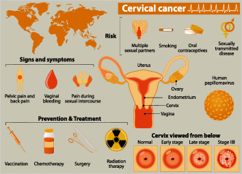 Cervical Cancer